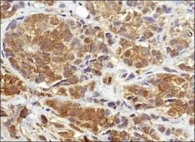 NQO1 Antibody in Immunohistochemistry (Paraffin) (IHC (P))