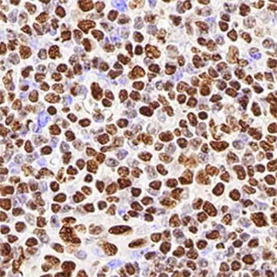 hnRNP M1-M4 Antibody in Immunohistochemistry (Paraffin) (IHC (P))