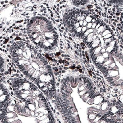 Bestrophin 1 Antibody in Immunohistochemistry (Paraffin) (IHC (P))