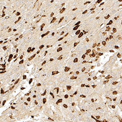 Bestrophin 1 Antibody in Immunohistochemistry (Paraffin) (IHC (P))