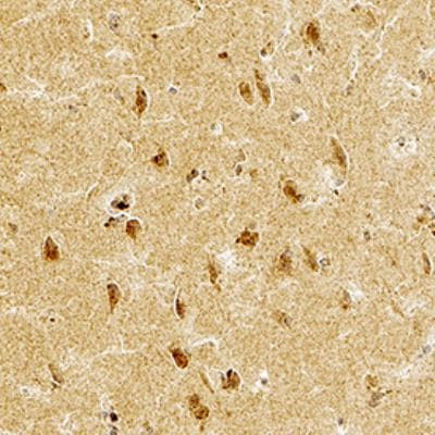 STEP Antibody in Immunohistochemistry (Paraffin) (IHC (P))