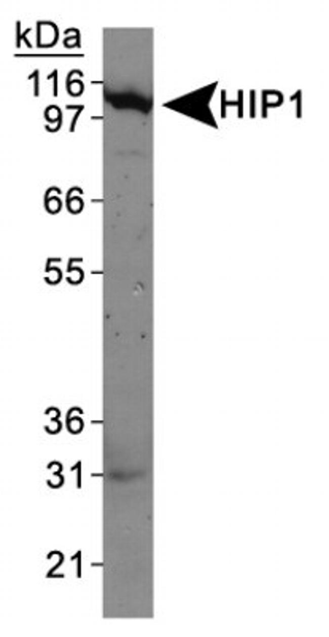 HIP1 Antibody in Western Blot (WB)