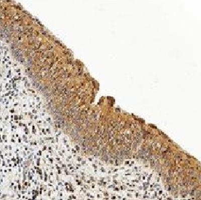 Caspase 3 Antibody in Immunohistochemistry (Paraffin) (IHC (P))