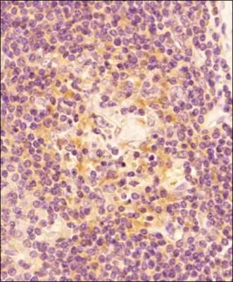 Caspase 3 Antibody in Immunohistochemistry (Paraffin) (IHC (P))