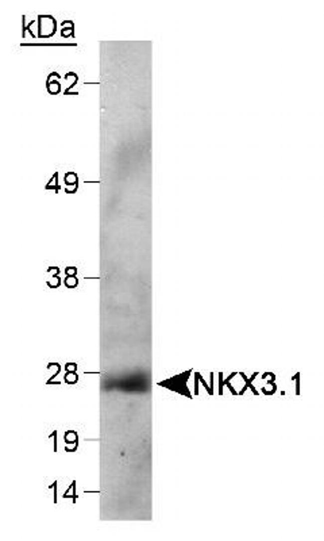 Nkx3.1 Antibody in Western Blot (WB)