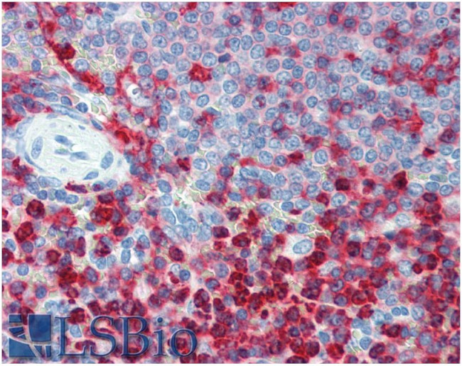 CD18 Antibody in Immunohistochemistry (Paraffin) (IHC (P))