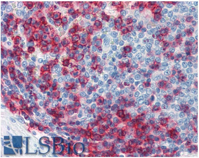 CD43 Antibody in Immunohistochemistry (Paraffin) (IHC (P))