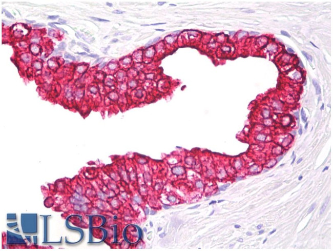 Cytokeratin 5/8 Antibody in Immunohistochemistry (Paraffin) (IHC (P))