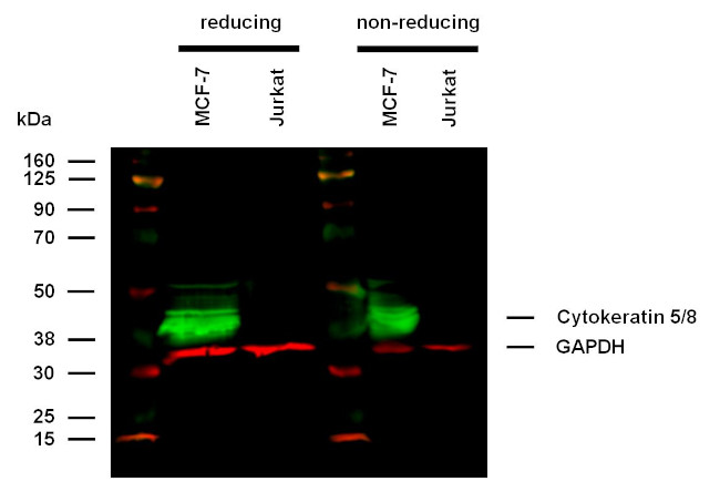 Cytokeratin 5/8 Antibody in Western Blot (WB)