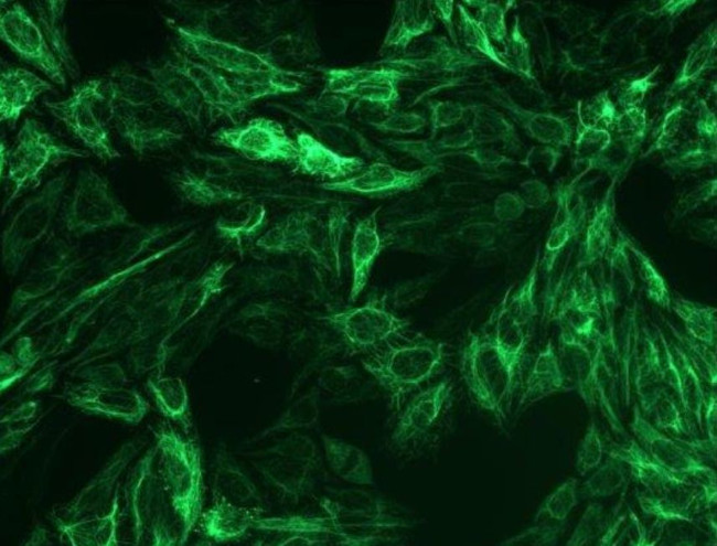 Cytokeratin 8 Antibody in Immunocytochemistry (ICC/IF)