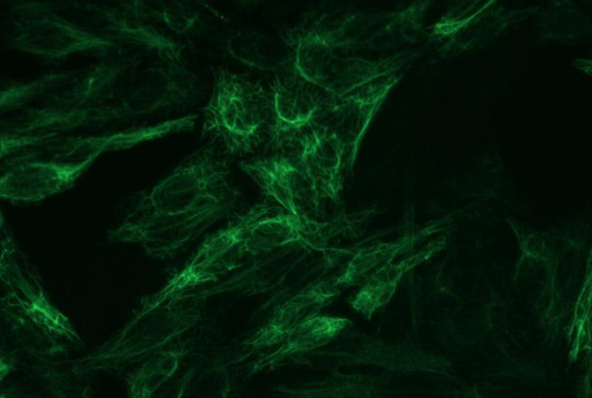 Cytokeratin 8 Antibody in Immunocytochemistry (ICC/IF)