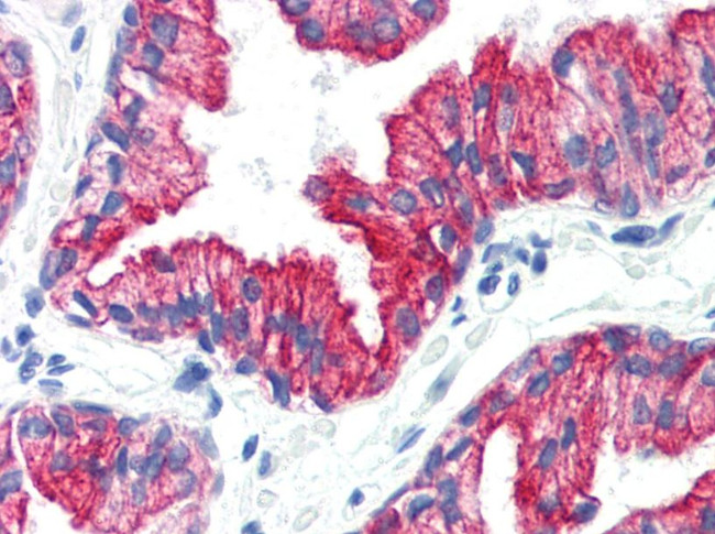 Cytokeratin 8 Antibody in Immunohistochemistry (Paraffin) (IHC (P))