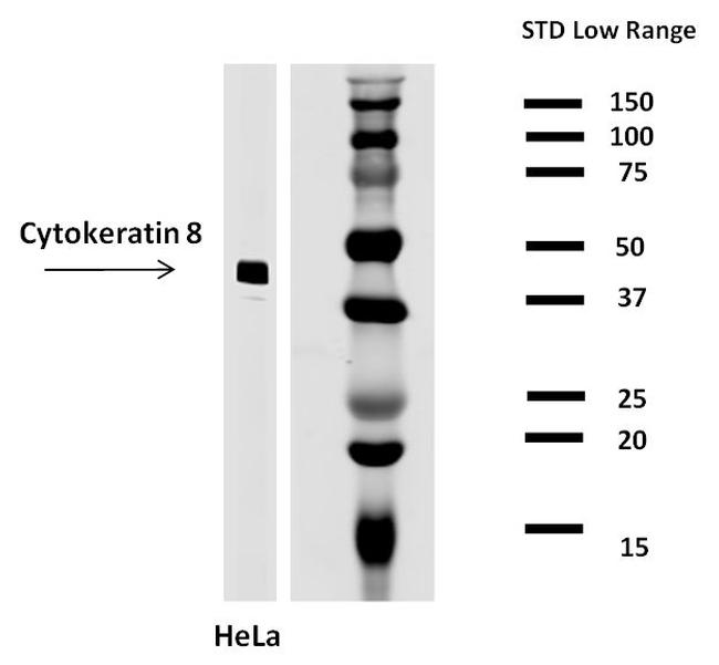 Cytokeratin 8 Antibody in Western Blot (WB)