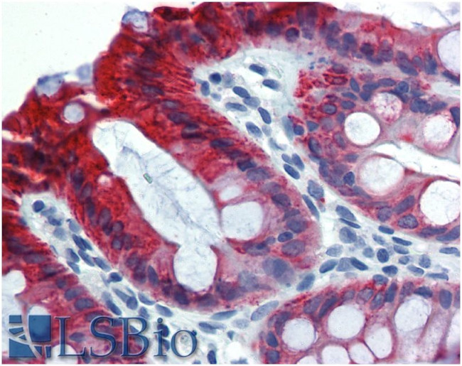 Cytokeratin 18 Antibody in Immunohistochemistry (Paraffin) (IHC (P))