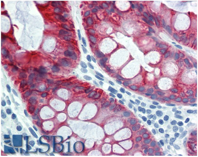 Cytokeratin 18 Antibody in Immunohistochemistry (Paraffin) (IHC (P))