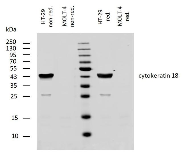 Cytokeratin 18 Antibody in Western Blot (WB)