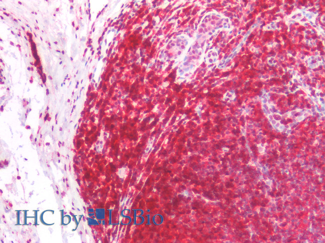 CD45RA Antibody in Immunohistochemistry (Paraffin) (IHC (P))