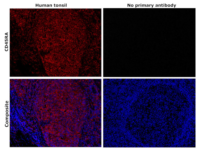 CD45RA Antibody in Immunohistochemistry (Paraffin) (IHC (P))