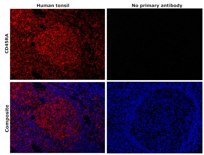 CD45RA Antibody in Immunohistochemistry (Paraffin) (IHC (P))