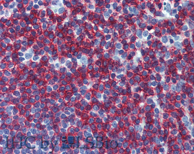 CD45RB Antibody in Immunohistochemistry (Paraffin) (IHC (P))