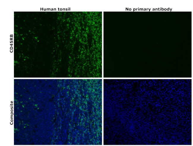 CD45RB Antibody in Immunohistochemistry (Paraffin) (IHC (P))