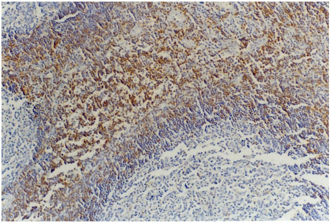 CD45RB Antibody in Immunohistochemistry (Paraffin) (IHC (P))