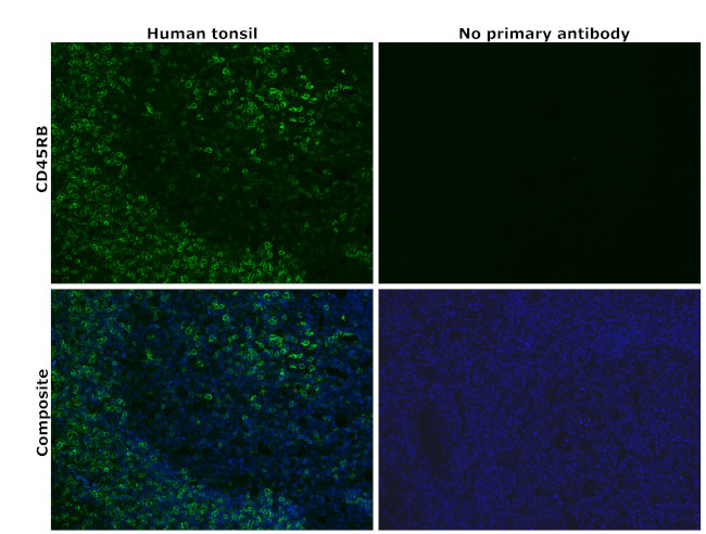 CD45RB Antibody in Immunohistochemistry (Paraffin) (IHC (P))