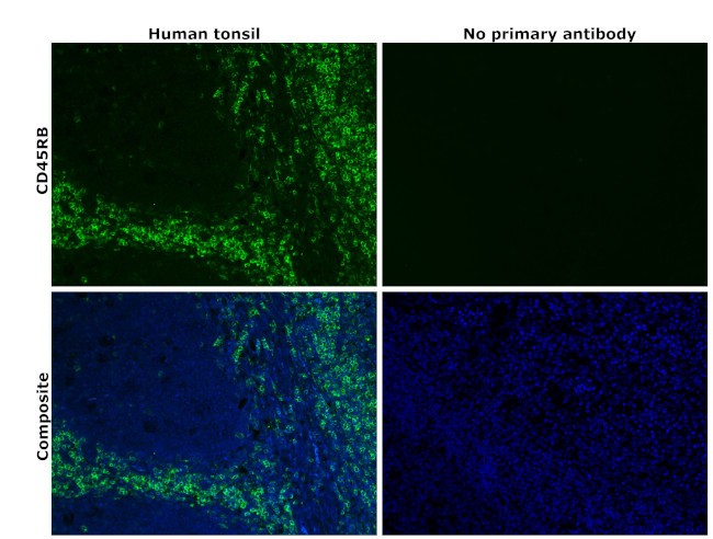 CD45RB Antibody in Immunohistochemistry (Paraffin) (IHC (P))