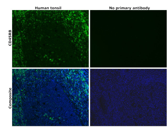 CD45RB Antibody in Immunohistochemistry (Paraffin) (IHC (P))