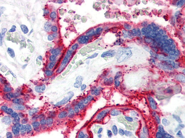 CD59 Antibody in Immunohistochemistry (Paraffin) (IHC (P))