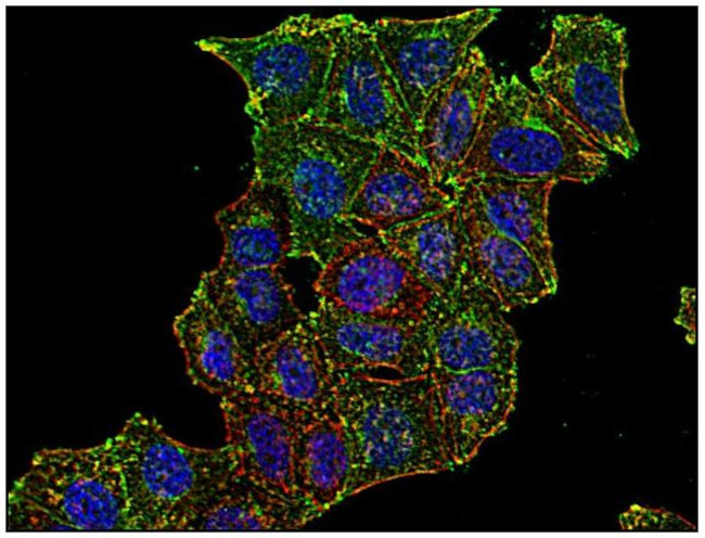 Transferrin Receptor Antibody in Immunocytochemistry (ICC/IF)