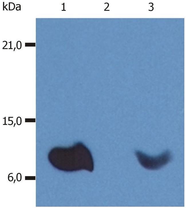 beta-2 Microglobulin Antibody in Western Blot (WB)