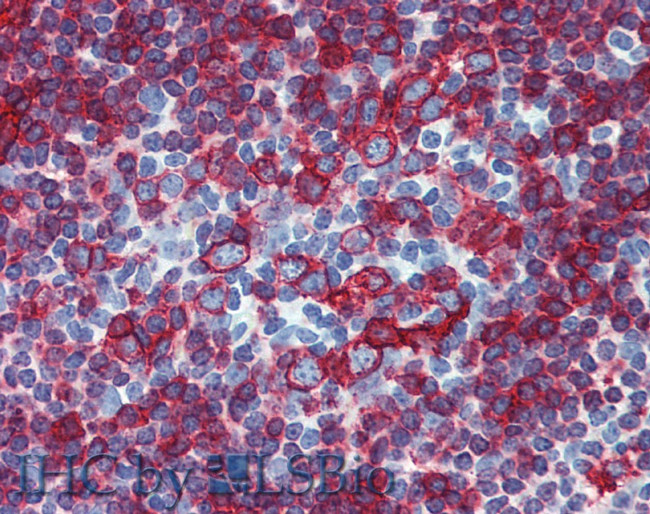 HLA-DR/DP Antibody in Immunohistochemistry (Paraffin) (IHC (P))