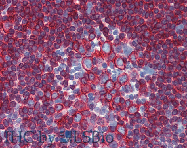 HLA-DR/DP Antibody in Immunohistochemistry (Paraffin) (IHC (P))