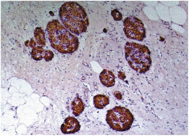 C-Peptide Antibody in Immunohistochemistry (Paraffin) (IHC (P))