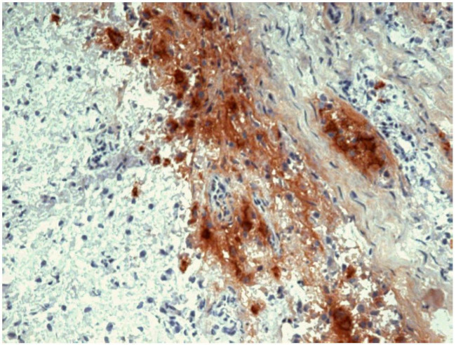 POMC Antibody in Immunohistochemistry (Paraffin) (IHC (P))