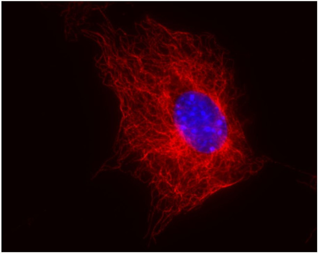 beta Tubulin Antibody in Immunocytochemistry (ICC/IF)