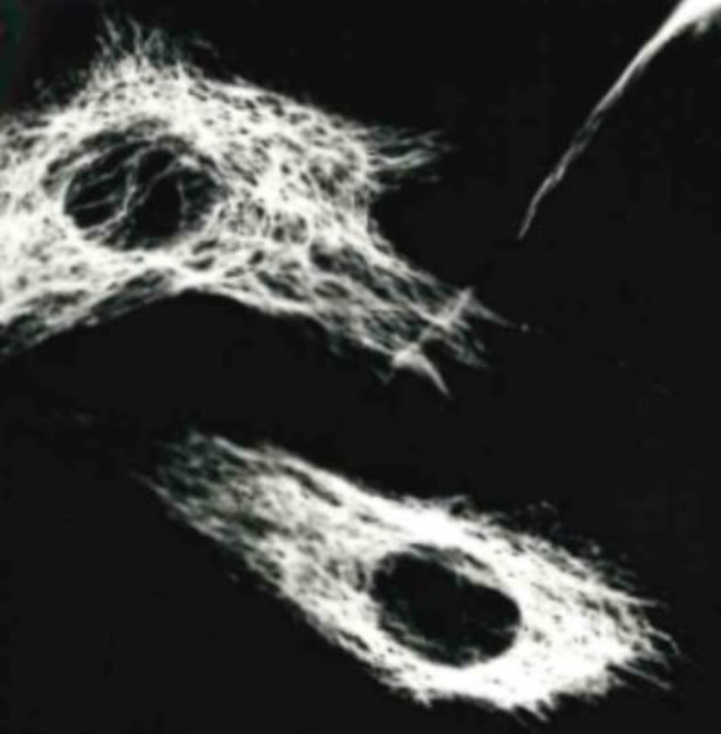 Vimentin Antibody in Immunocytochemistry (ICC/IF)