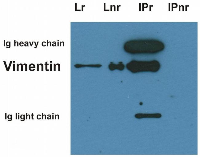 Vimentin Antibody in Western Blot (WB)