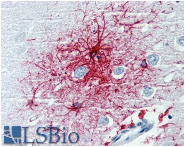 GFAP Antibody in Immunohistochemistry (Paraffin) (IHC (P))