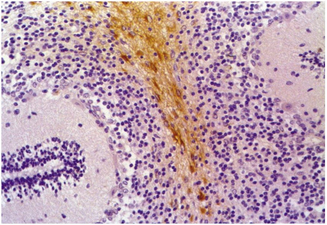 GFAP Antibody in Immunohistochemistry (Paraffin) (IHC (P))