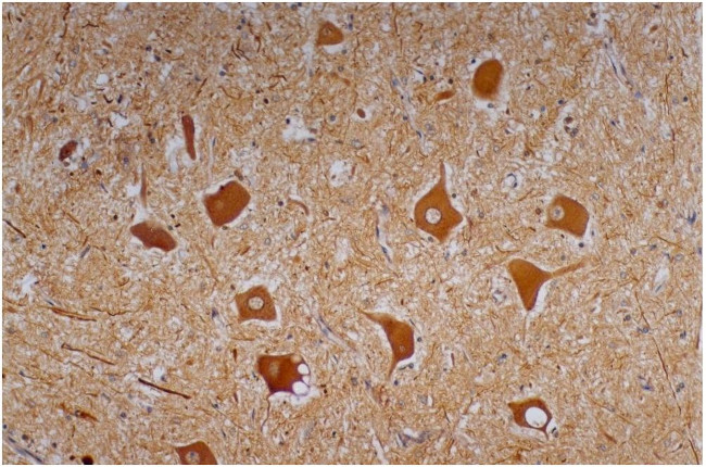 NF-H Antibody in Immunohistochemistry (Paraffin) (IHC (P))