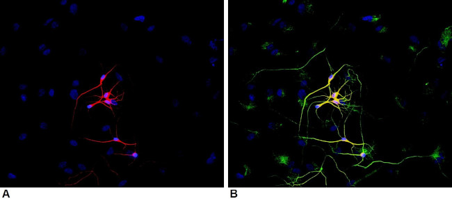 beta-3 Tubulin Antibody in Immunocytochemistry (ICC/IF)