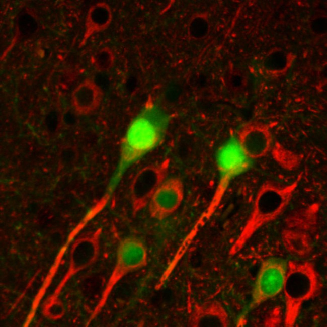 beta-3 Tubulin Antibody in Immunohistochemistry (Paraffin) (IHC (P))