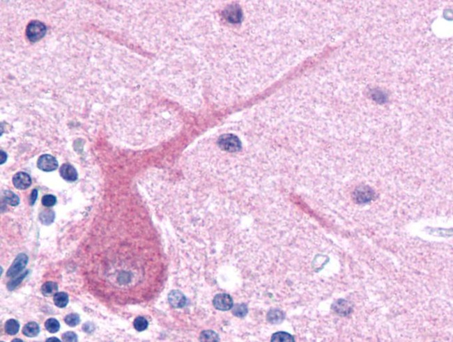 beta-3 Tubulin Antibody in Immunohistochemistry (Paraffin) (IHC (P))