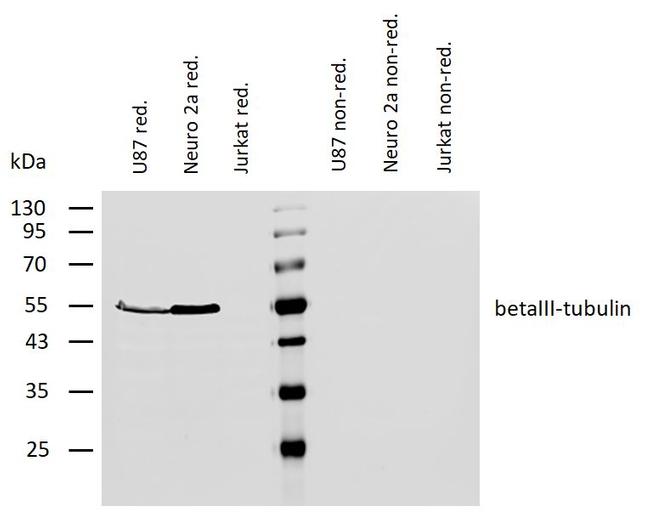 beta-3 Tubulin Antibody in Western Blot (WB)