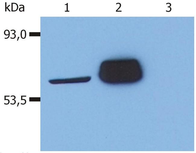 LCK Antibody in Western Blot (WB)