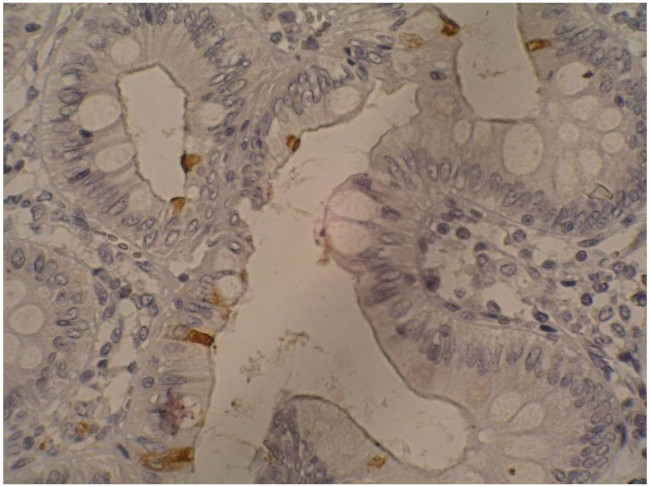 CA19-9 Antibody in Immunohistochemistry (Paraffin) (IHC (P))