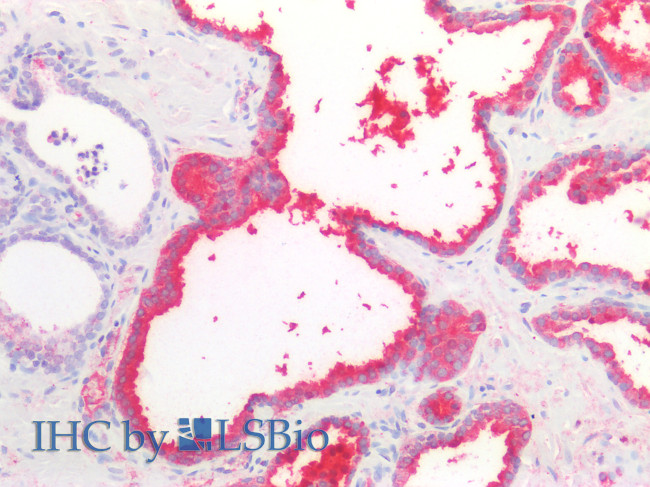 PSA Antibody in Immunohistochemistry (Paraffin) (IHC (P))