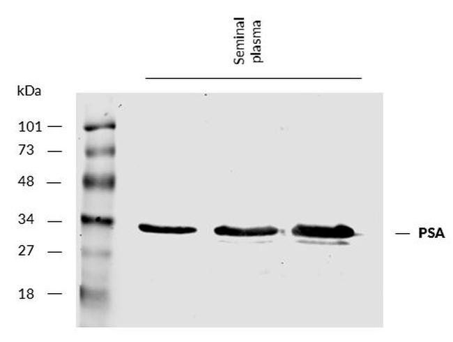 PSA Antibody in Western Blot (WB)